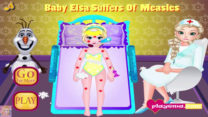 Baby Elsa Suffers of Measles - Frozen Elsa Doctor Games for Kids