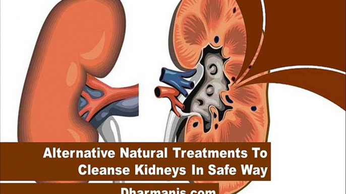 Alternative Natural Treatments To Cleanse Kidneys In Safe Way