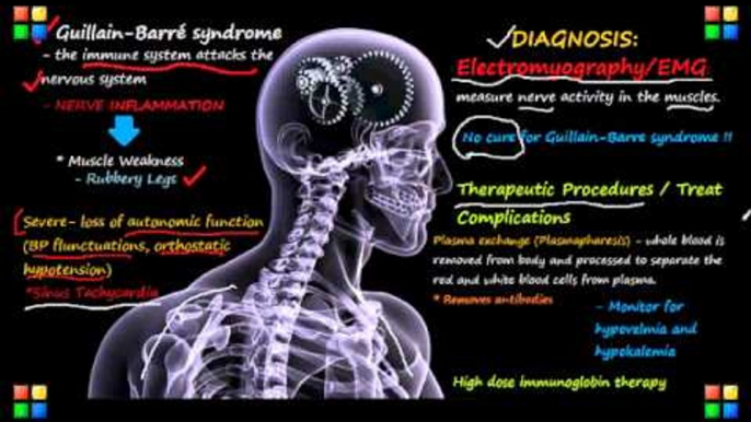 Guillain-Barre Syndrome(CBS): Causes, Symptoms & Diagnosis