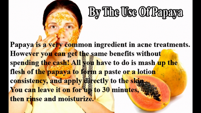 How To Get Rid Of Pimples ¦ Health And Wealth