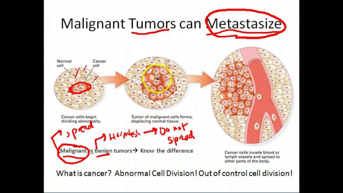 Biology: Cancer