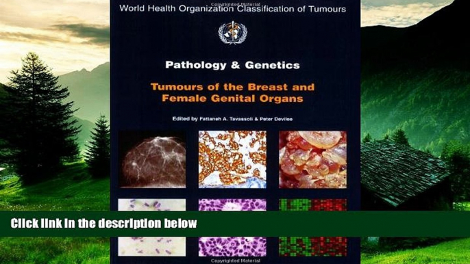 READ FREE FULL  Pathology and Genetics of Tumours of the Breast and Female Genital Organs (IARC