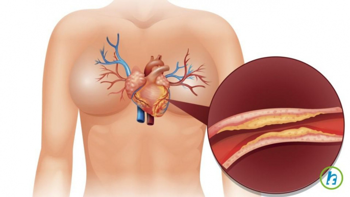 Heart Disease Occurence Decreasing