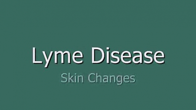 Lyme Skin Changes - Morgellons Cure (#1 of 6)