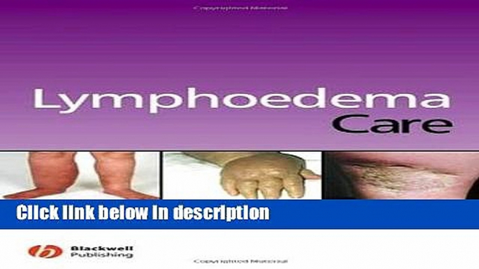 Ebook Lymphoedema Care Full Online