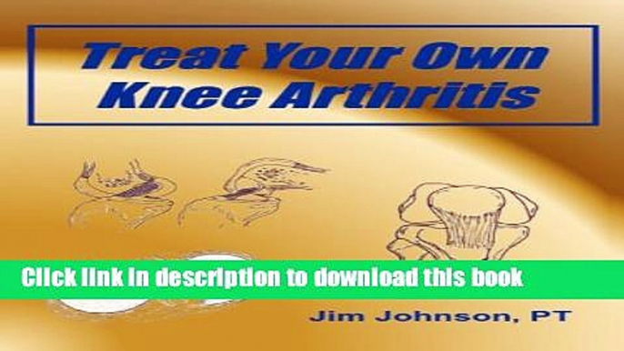 [Read PDF] Treat Your Own Knee Arthritis Download Online