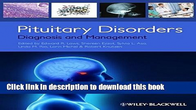 PDF  Pituitary Disorders: Diagnosis and Management  Free Books KOMP B