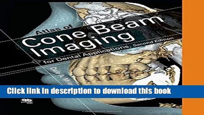 Ebook Atlas of Cone Beam Imaging for Dental Applications Free Online