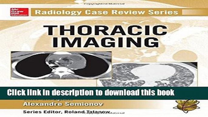 Ebook Radiology Case Review Series: Thoracic Imaging Full Online