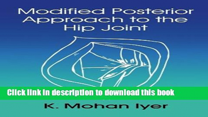 Ebook Modified Posterior Approach to the Hip Joint Full Online