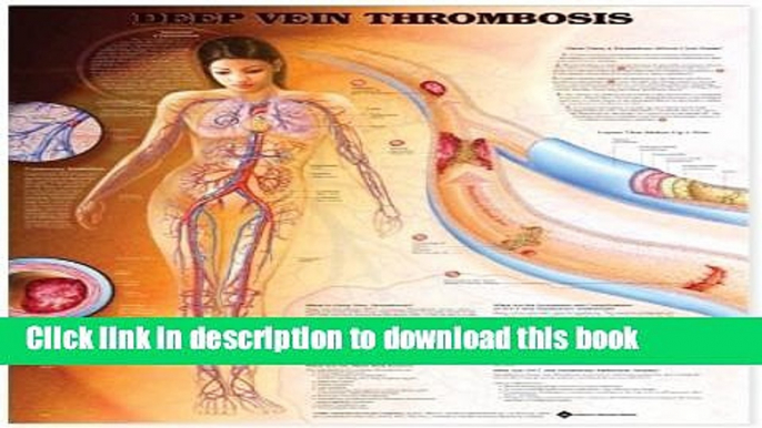 Books Deep Vein Thrombosis Anatomical Chart Full Online