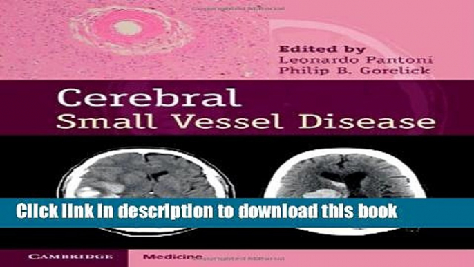 Ebook Cerebral Small Vessel Disease Full Download