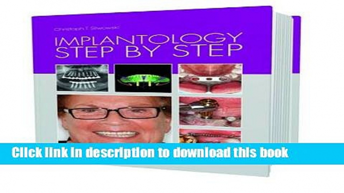 [Download] Implantology Step by Step Hardcover Collection