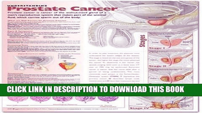 [READ] EBOOK Understanding Prostate Cancer Anatomical Chart BEST COLLECTION