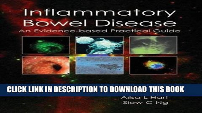 Best Seller Inflammatory Bowel Disease: An Evidence-Based Practical Guide Free Download