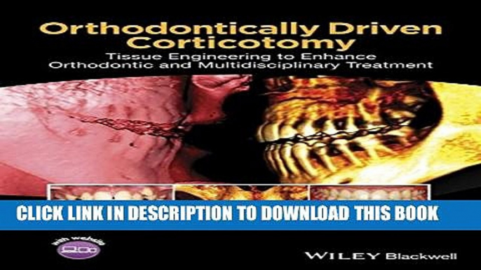 [Download] Orthodontically Driven Corticotomy: Tissue Engineering to Enhance Orthodontic and