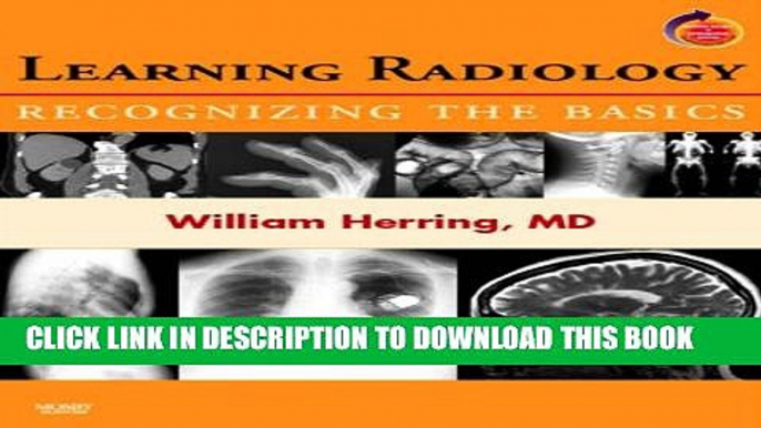 New Book Learning Radiology: Recognizing the Basics (With STUDENT CONSULT Online Access), 1e