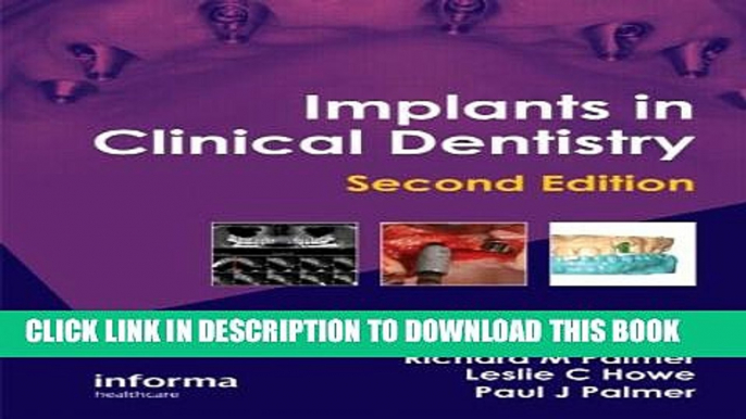 Collection Book Implants in Clinical Dentistry, Second Edition