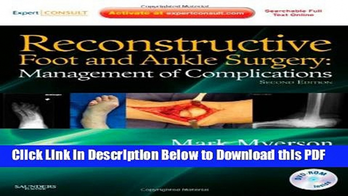 [Read] Reconstructive Foot and Ankle Surgery: Management of Complications: Expert Consult -