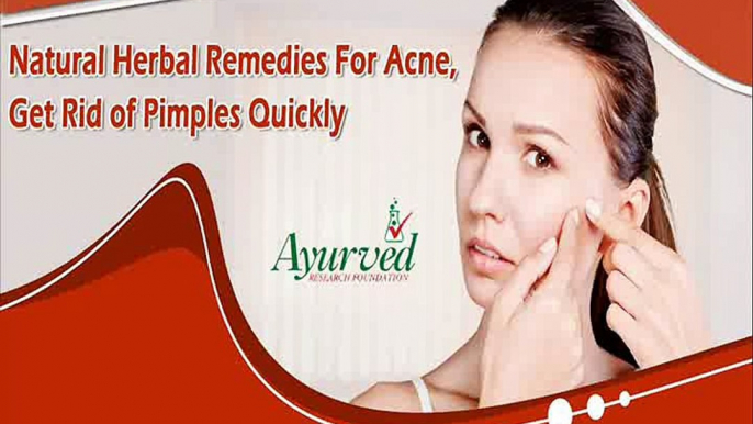 Natural Herbal Remedies For Acne, Get Rid of Pimples Quickly