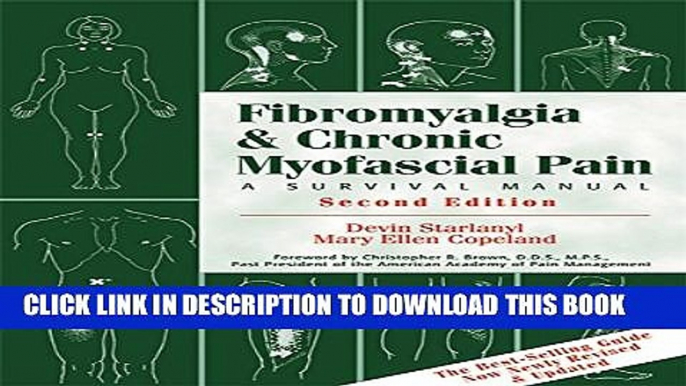 [PDF] Fibromyalgia and Chronic Myofascial Pain: A Survival Manual Full Online