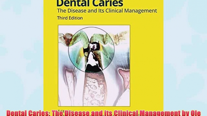 [PDF] Dental Caries: The Disease and its Clinical Management by Ole Fejerskov (Editor) Bente