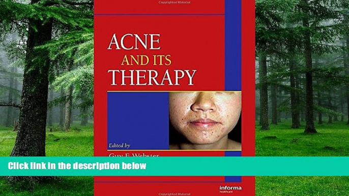 Big Deals  Acne and Its Therapy (Basic and Clinical Dermatology)  Free Full Read Best Seller