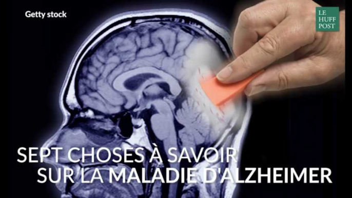 Sept choses à savoir sur la maladie d'Alzheimer