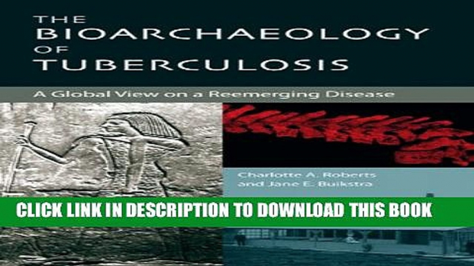 [PDF] The Bioarchaeology of Tuberculosis: A Global View on a Reemerging Disease Full Online