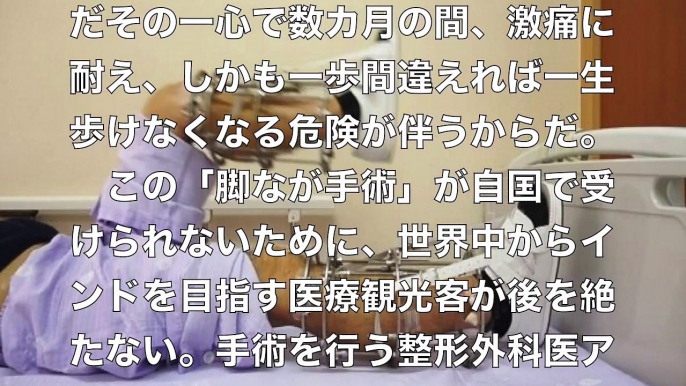 【驚愕】インドの脚なが手術がヤバすぎる！ 164センチが182センチへ…医療観光客殺到も危険がいっぱい