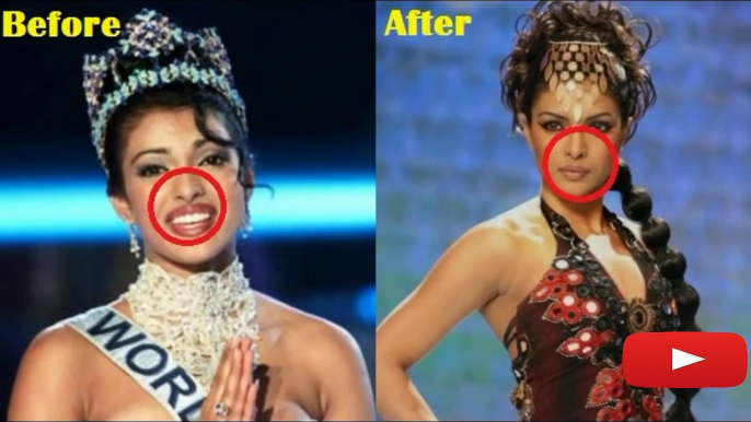 Bollywood Actresses And Their Plastic Surgeries! Before and After 2016