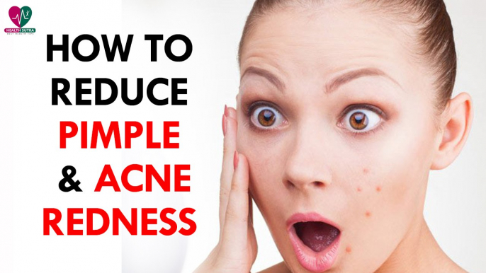 How to Reduce Pimple & Acne Redness - Health Sutra