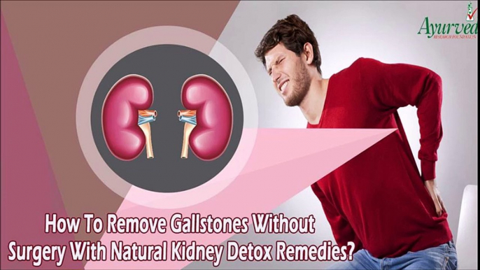 How To Remove Gallstones Without Surgery With Natural Kidney Detox Remedies