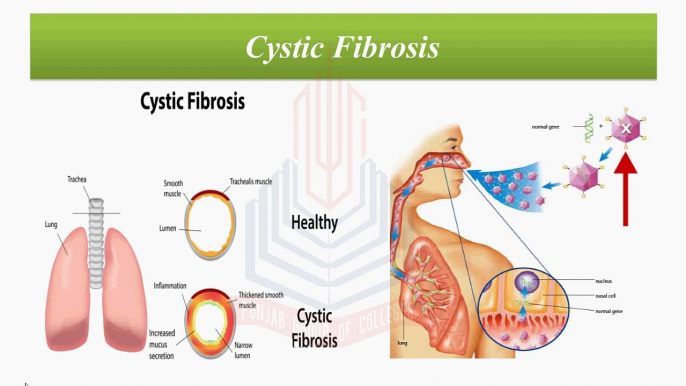 In-vivo Gene Therapy, Cystic Fibrosis, cancer Treatment, Coronary Artery Angioplasty, Treatment of hemophilia, diabetes or aids