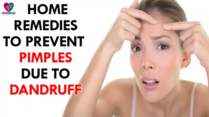 Home Remedies To Prevent Pimples Due To Dandruff- health Sutra