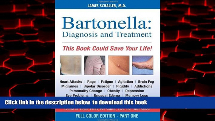 Best books  Bartonella: Diagnosis and Treatment: Part 1 of 2, Full Color Edition (Dhivehi Edition)