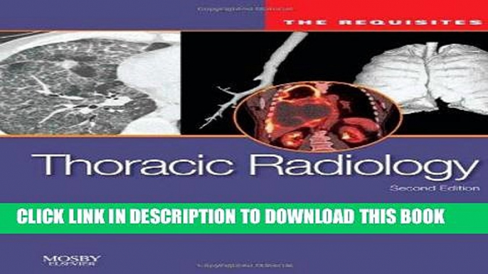 [PDF] Thoracic Radiology: The Requisites, 2e (Requisites in Radiology) Popular Online