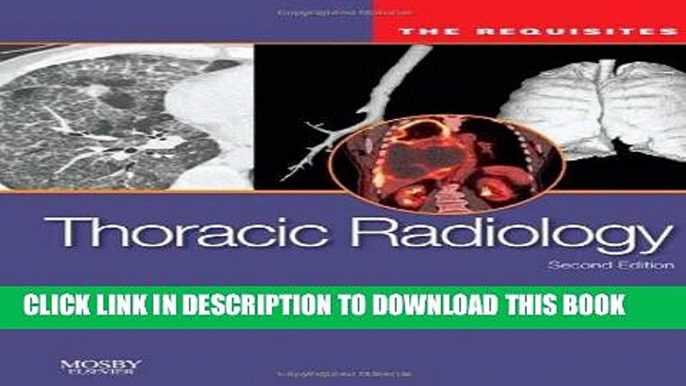 [PDF] Thoracic Radiology: The Requisites, 2e (Requisites in Radiology) Full Online