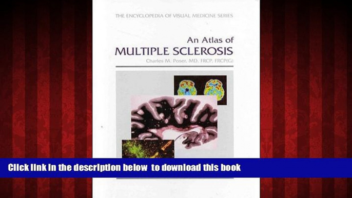 liberty book  An Atlas of Multiple Sclerosis BOOOK ONLINE