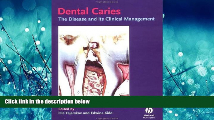 READ book Dental Caries: The Disease and Its Clinical Management [DOWNLOAD] ONLINE