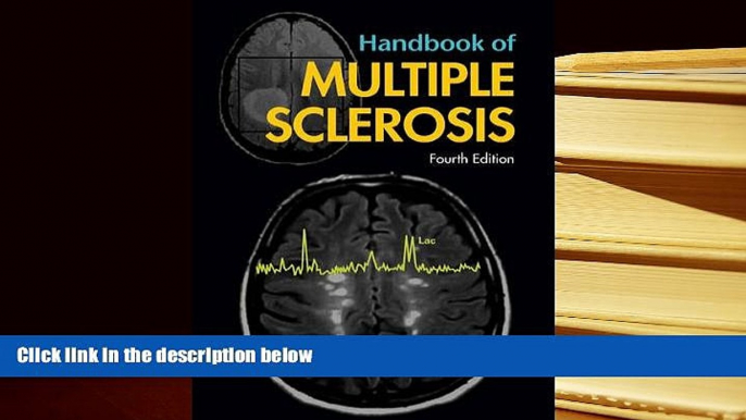 Kindle eBooks  Handbook of Multiple Sclerosis, Fourth Edition (Neurological Disease and Therapy)