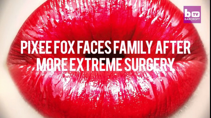 Pixee Fox Faces Family After More Extreme Surgery HOOKED ON THE LOOK
