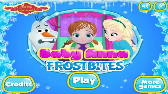 Baby Anna Frostbites - Baby Games Videos HD/16:9 - Frozen Princess Gameplay