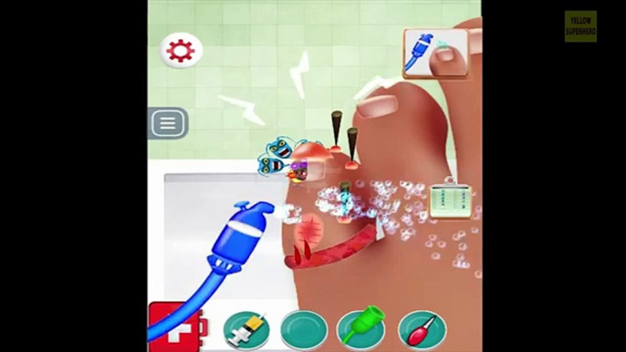 Uñas Del Dedo Del Pie Médico – Juegos Divertidos Android Juego