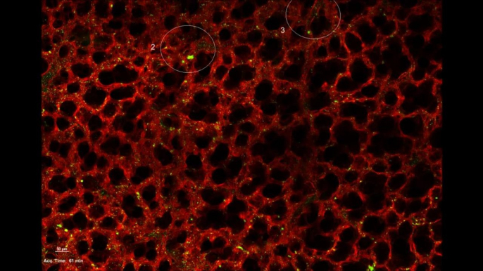 Vue au microscope à fluorescence de poumons de souris (des cellules sanguines apparaissent, en vert)