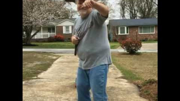 Man With "Knife Through His Head" Goes Skateboarding Holding Nunchucks