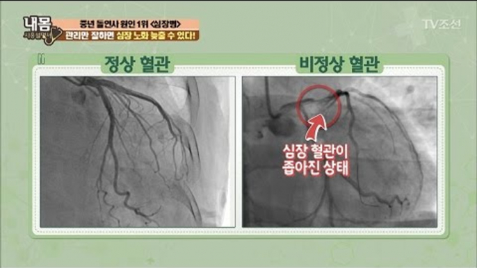 심장, 관리만 잘하면 노화 늦출 수 있다?! [내 몸 사용설명서] 145회 20170315