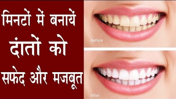 यह उपाए मिनटों में दांतों को चमका देगें मोतियों जैसा | How To Get White Teeth At Home