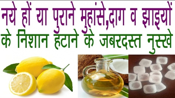 How To Remove Pimples,Black Spot,Wrinkles And Marks |मुँहासे,दाग धब्बे व झाइयां हटाने के अचूक नुस्खे