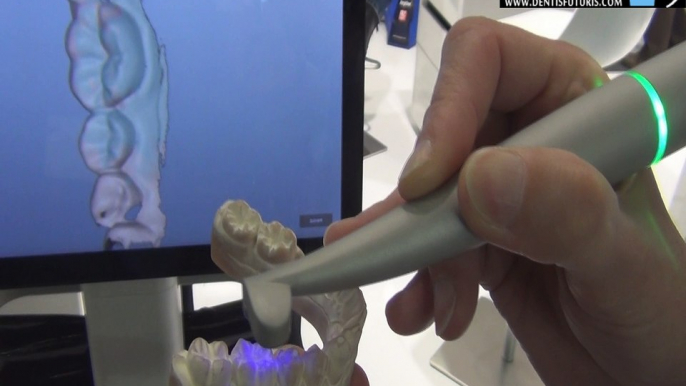 #IDS2017 : présentation du scanner intra oral Dental Wings